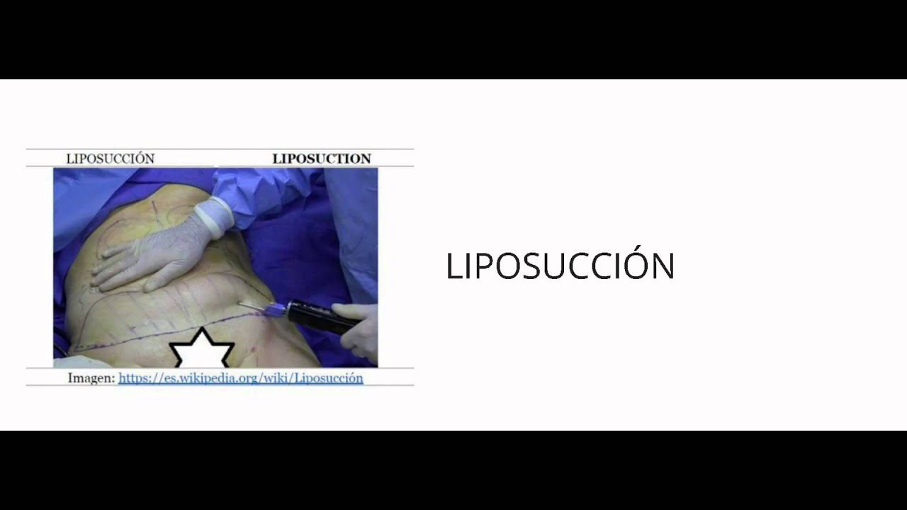 medicina-estetica-en-ingles - Barcelona Noticias 24h medicina estetica en ingles