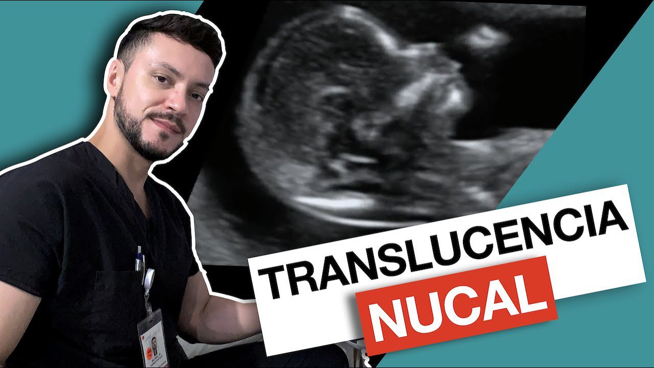 medicina-fetal-barcelona-translucencia-nucal - Barcelona Noticias 24h medicina fetal barcelona translucencia nucal
