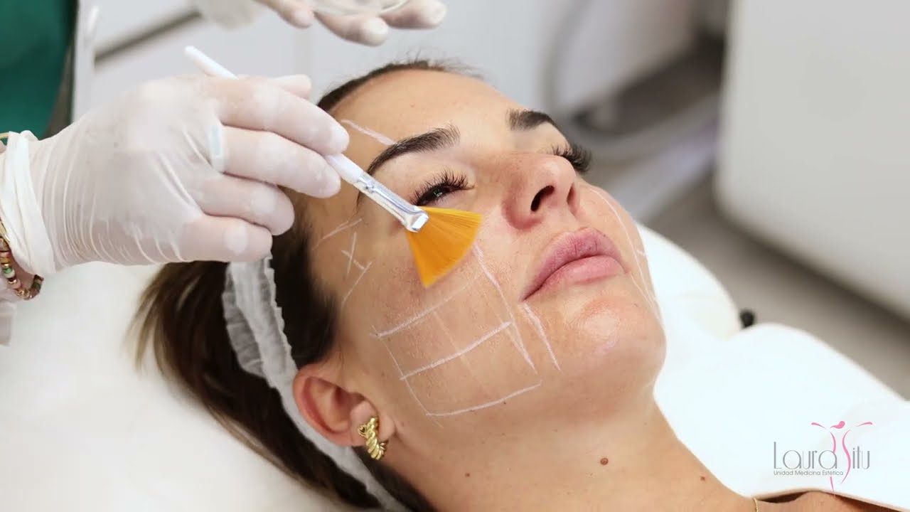clinica-dra-laura-situ-medicina-estetica-en-barcelona - Barcelona Noticias 24h clínica dra laura sitú medicina estética en barcelona