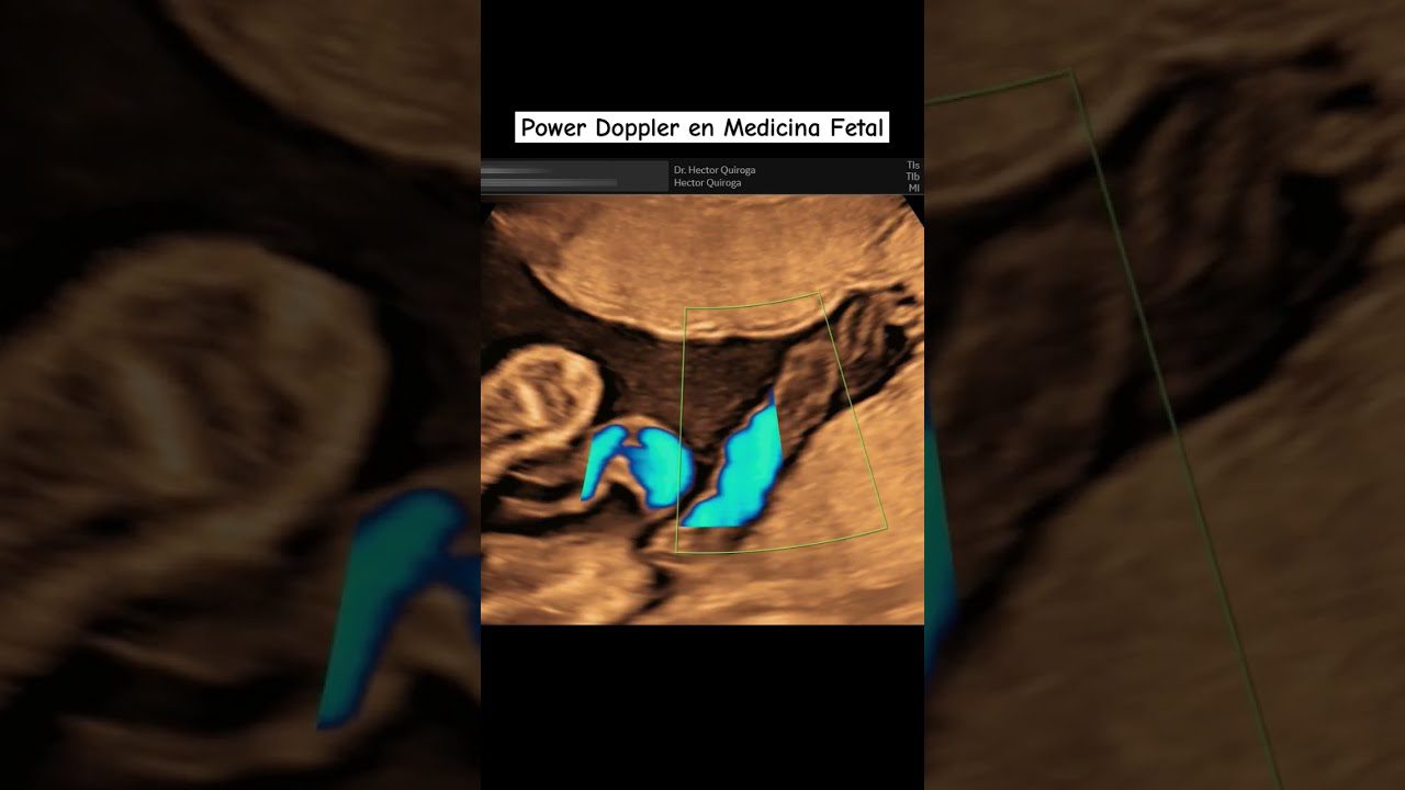 medicina-fetal-barcelona-doppler - Barcelona Noticias 24h medicina fetal barcelona doppler