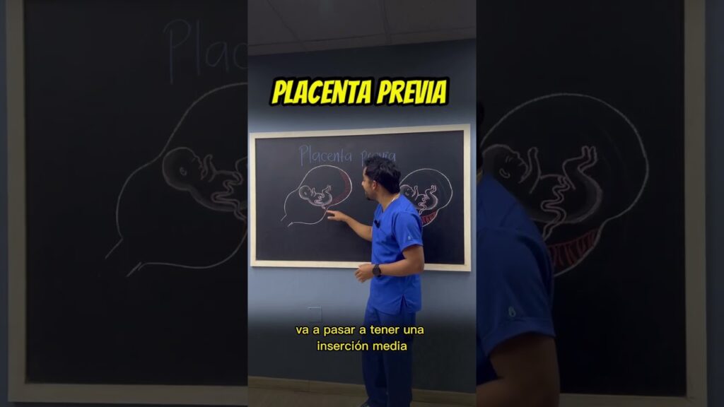 medicina fetal barcelona placenta previa