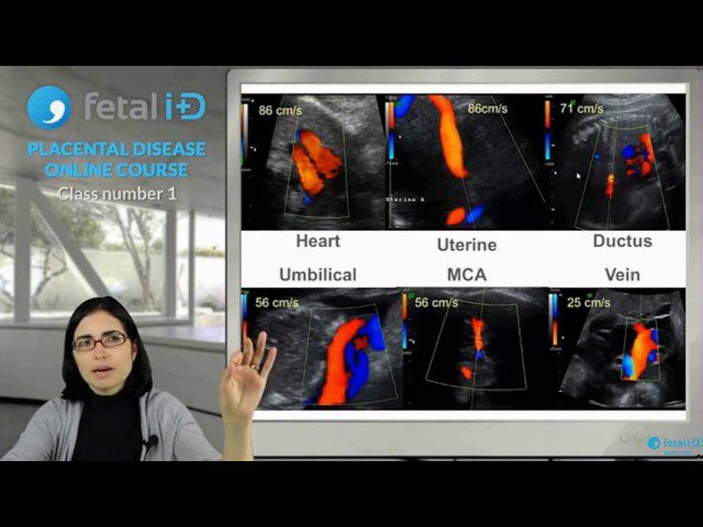 medicina fetal barcelona doppler obstetrico