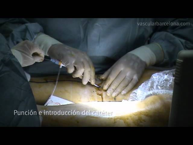 medicina-vascular-barcelona - Barcelona Noticias 24h medicina vascular barcelona