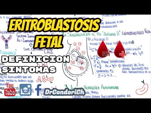 medicina fetal barcelona isoinmunizacion