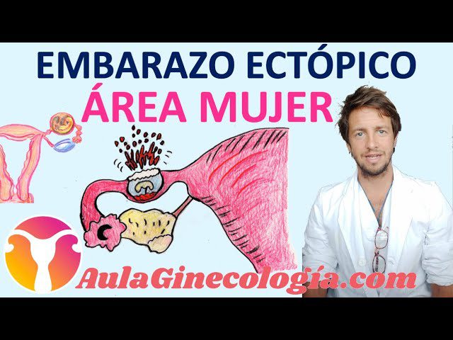 medicina-fetal-barcelona-ectopico - Barcelona Noticias 24h medicina fetal barcelona ectopico