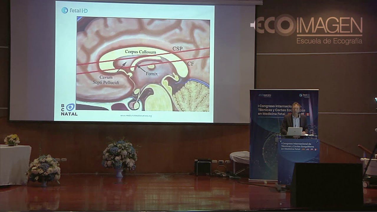 medicina-fetal-barcelona-neurosonografia - Barcelona Noticias 24h medicina fetal barcelona neurosonografia